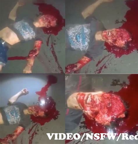 Video Nsfw Extreme Gore A Shocking Accident In Guatemala Leaves A Man With His Skull Totally