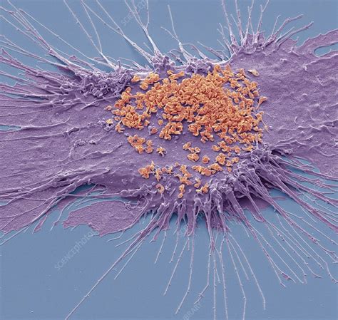 Mycoplasma Sem Stock Image C0481379 Science Photo Library