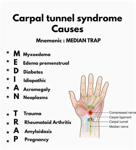 Learn Causes Of Carpal Tunnel Syndrome Medizzy