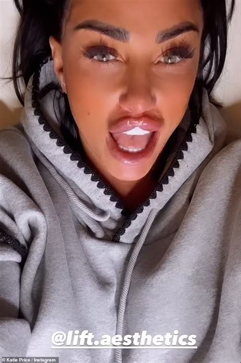 Katie Price Shocks As She Reveals The Results Of Her Bum Lift In Tiny