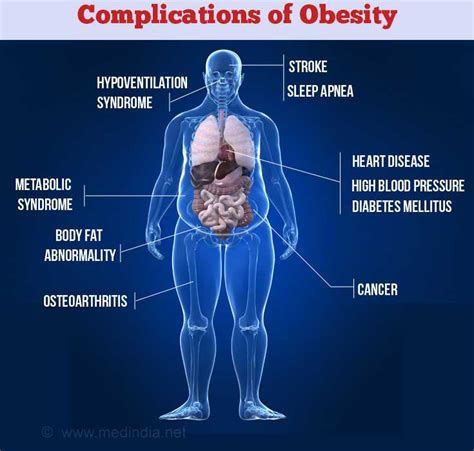 Obesity Complications 1 McIsaac Health Systems Inc