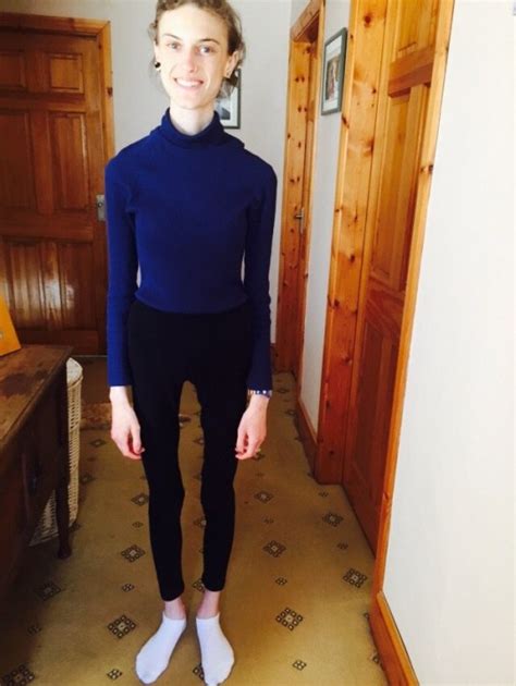Anorexia Survivor Who Weighed Just 5st Shares Pictures Of Remarkable