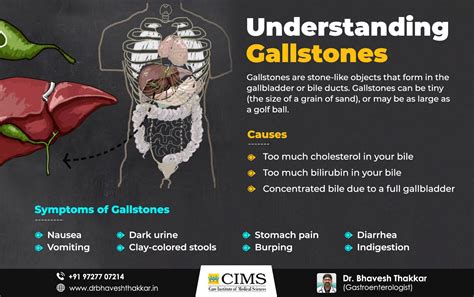 Gallstones Digestive Disease Gallbladder Inflammatory Bowel Disease