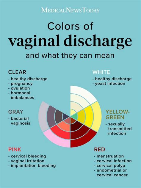 vaginal discharge color guide causes and when to see a doctor