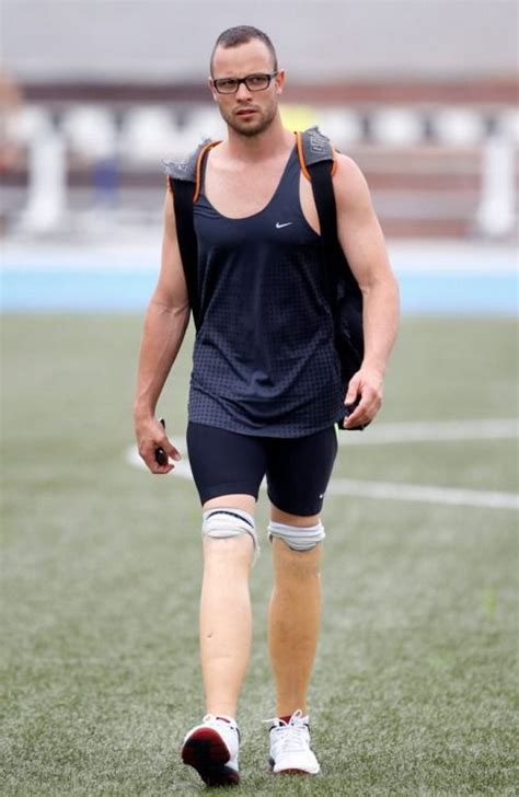 His Prosthetic Legs Look So Realistic Wow Prosthetic Leg Legs