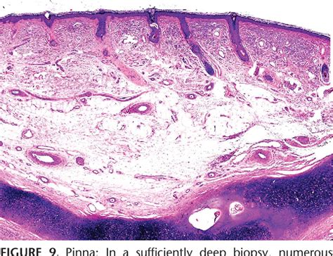 Figure 9 From Regional Variations In The Histology Of The Skin