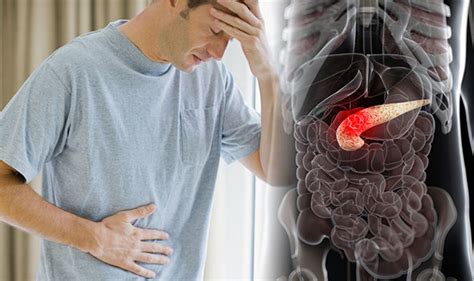 When signs and symptoms of pancreatic cancer occur, they include (these to not occur in pancreatitis): Pancreatic cancer symptoms and causes: Three early signs ...