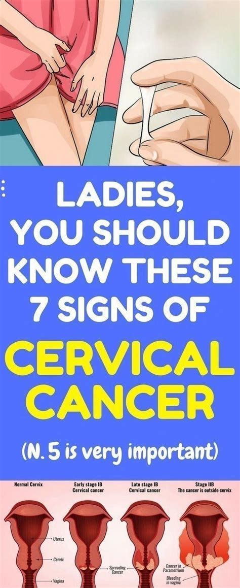 10 Warning Signs Of Cervical Cancer You Should Not Ignore Remedy Portal