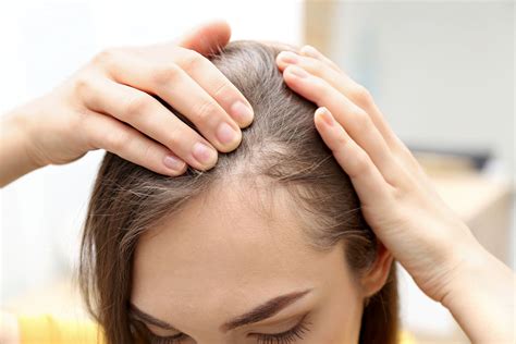 Blog El Mejor Tratamiento Para La Alopecia Femenina