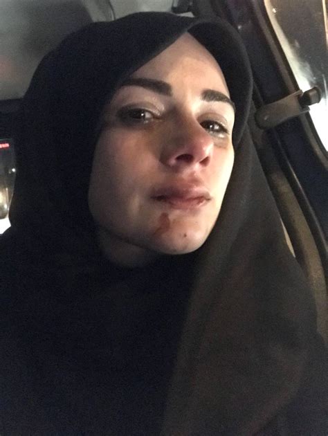 Sosyal medya fenomeni Elif Kübra Genç saldırıya uğradı Olay
