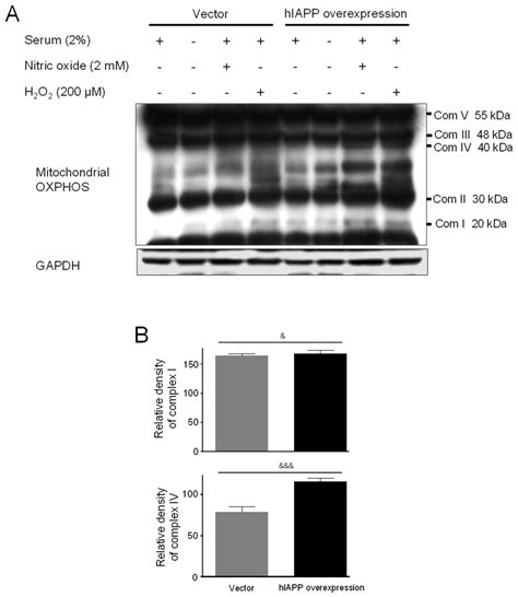 Ijms Free Full Text Human Islet Amyloid Polypeptide Overexpression