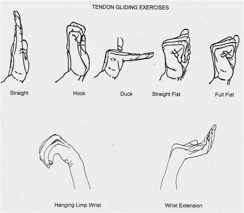 Median Nerve Glide Exercises