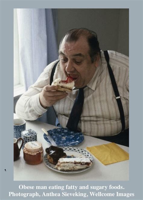 Obese Man Eating Fatty And Sugary Foods Lit Med Magazine