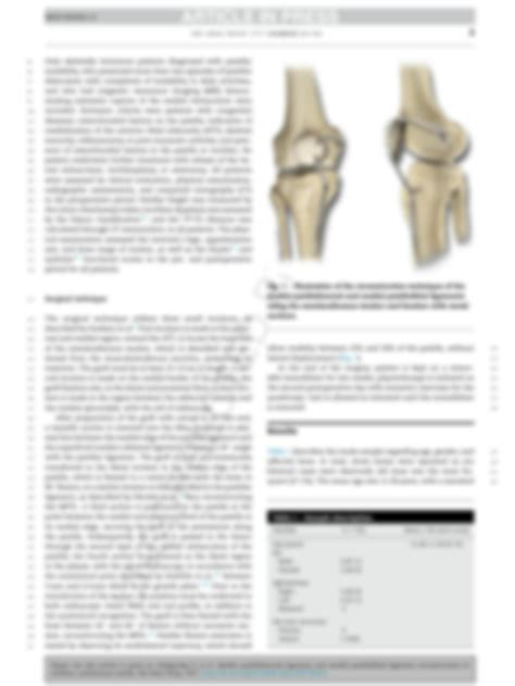 Solution Medial Patellofemoral Ligament And Medial Patellotibial