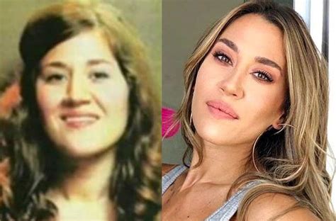 Antes Y Después De Las Cirugías Las Fotos De Famosas Argentinas