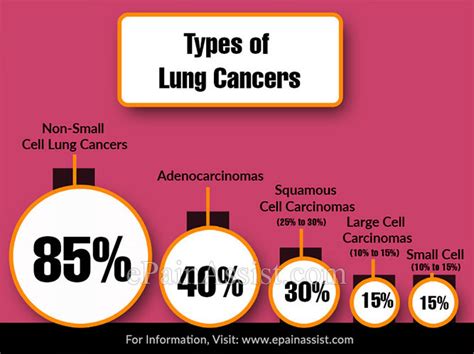 Nsclc has three main types designated by the type of cells found in the tumor. Types of Lung Cancer