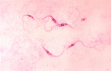 Trypanosome Wikidoc