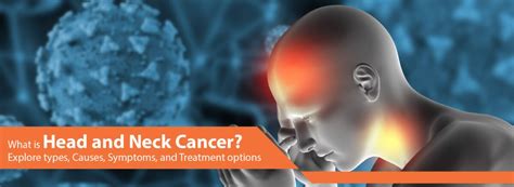 What Is Head And Neck Cancer Explore Types Causes Symptoms And
