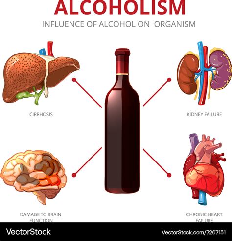 Long Term Effects Of Alcohol Alcoholism Royalty Free Vector