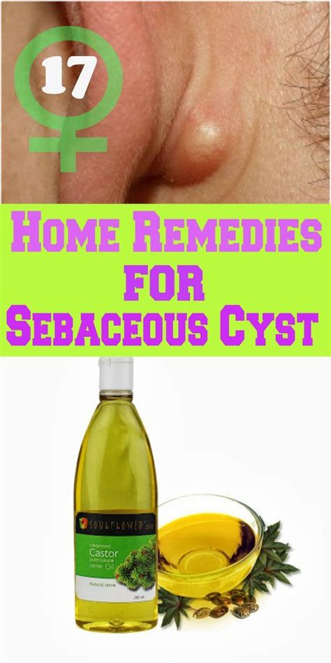 17 Home Remedies For Sebaceous Cyst Natural Health Tips Health