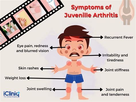 Juvenile Arthritis Childhood Arthritis Causes Types Symptoms