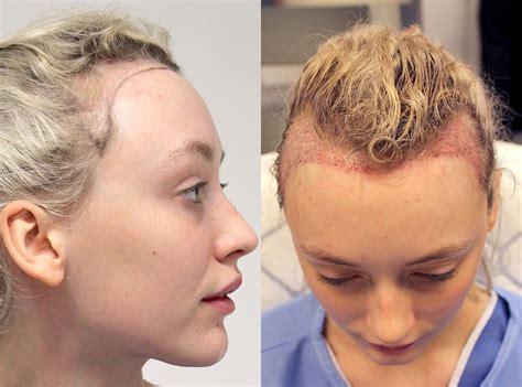 Womens Haircuts For Receding Hairline Lets Cut Your Hair