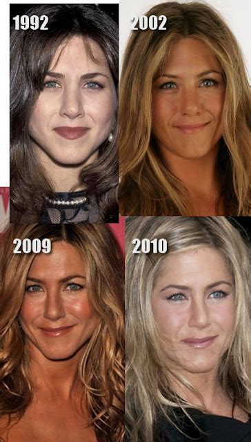 Jennifer Aniston Plastic Surgery Before And After Nose Job And Facelift Plastic Surgery