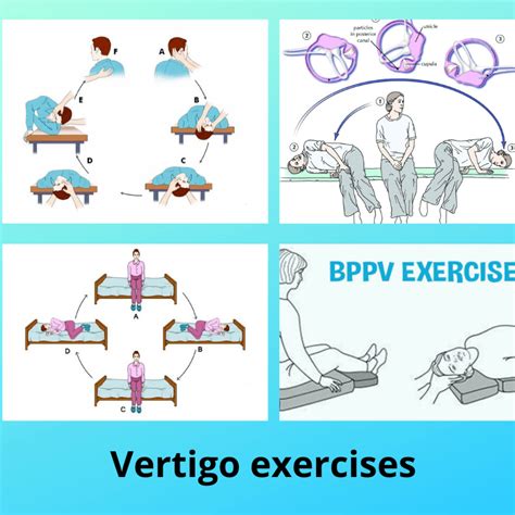Get Epley Maneuver Vertigo Exercises Background