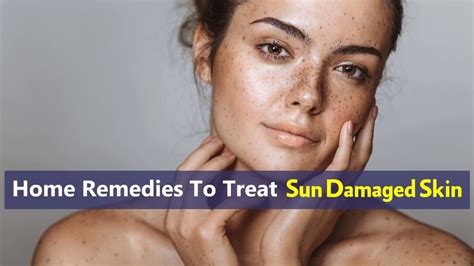 Home Remedies To Treat Sun Damaged Skin Youtube