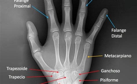 Huesos De La Mano Vision Anterior Con Imagenes Anatomia Y Fisiologia