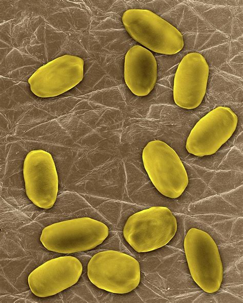 Bacillus Anthracis Spores Photograph by Dennis Kunkel Microscopy ...