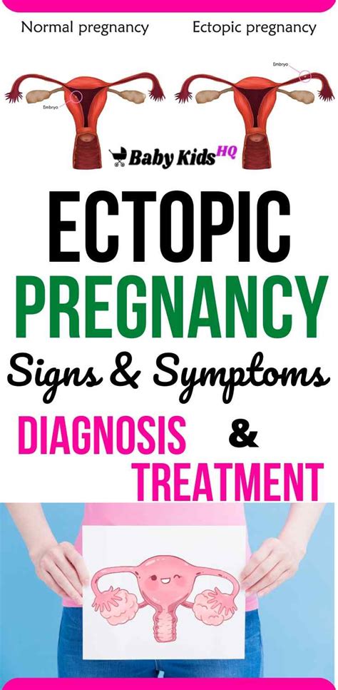 Ectopic Pregnancy Signs And Symptoms Diagnosis And Treatment Babykidshq