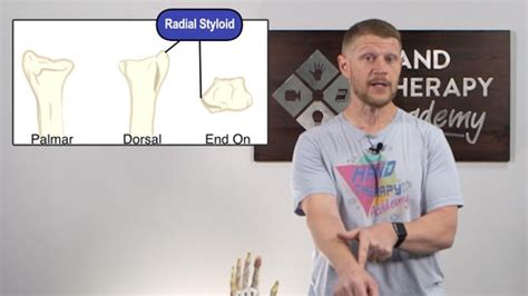 Distal Radius Fracture Training Hand Therapy Academy