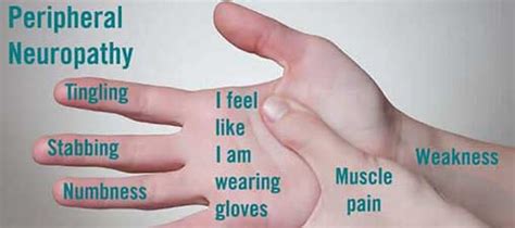 Peripheral Neuropathy Hands