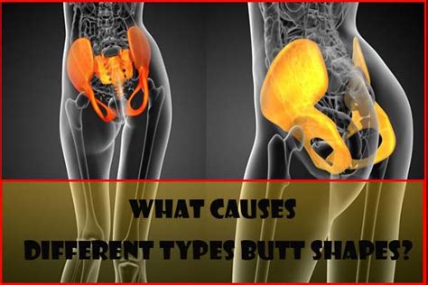 Different Types Of Buttocks On Females Which Butt Shapes Do You Have
