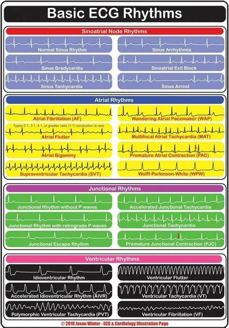 Pin By Carla Chipman On Medical Emergency Nursing Critical Care