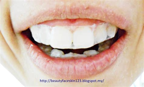 3d white whitestrips provide you with a beautiful, whiter smile. GREAT SKIN&LIFE: REVIEW ON ORAL-B 3D WHITE WHITESTRIPS