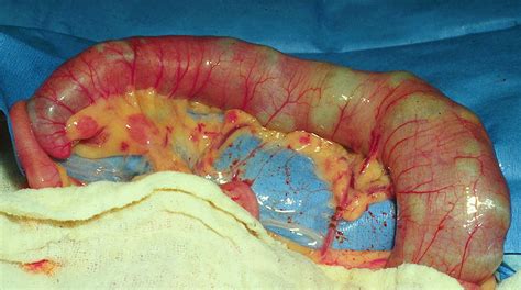 Megacolon happens when the nerves to the colon aren't working correctly. Veterinary Key Points: Idiopathic Megacolon in Cats: Let's ...
