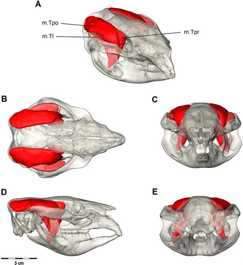 Digital Dissection Of The Temporalis Muscle Group A Oblique B