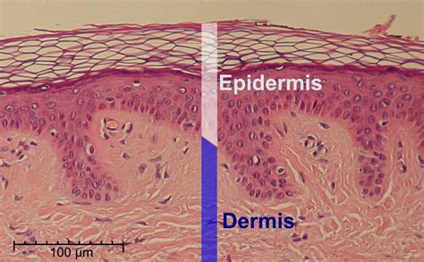 Fileepidermis Delimited Wikimedia Commons