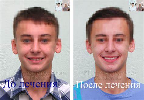 Чтоб лицо похудело что нужно