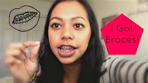 what to expect when getting braces youtube