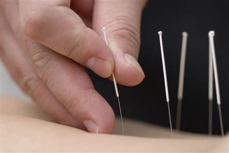 Traditional Chinese Acupuncture East West Healing Solutions