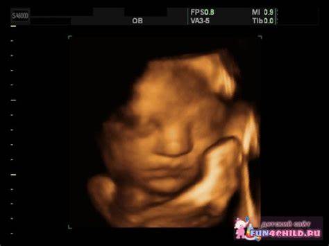 34-я неделя беременности | форум Babyblog Картинка - 34-я неделя беременности | форум Babyblog