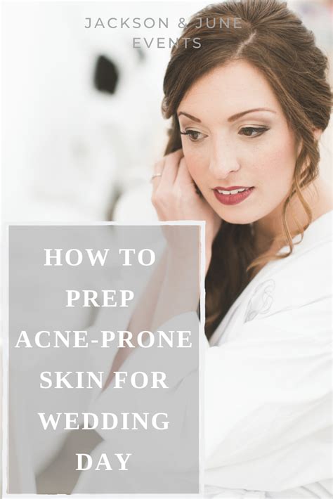 How To Prep Acne Prone Skin For Your Wedding Day Acne Prone Skin