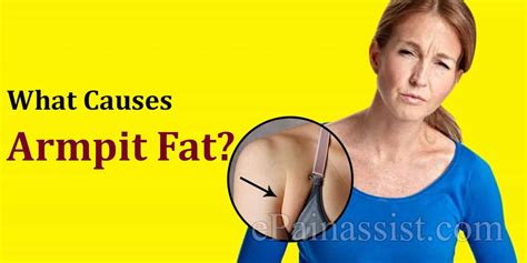 What Causes Armpit Fat And How To Reduce It