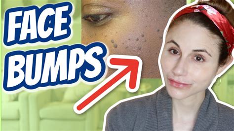 How To Get Rid Of Bumps On The Face Dr Dray Youtube