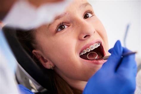 Learn About Phase Two Early Orthodontic Treatment Hawthorne
