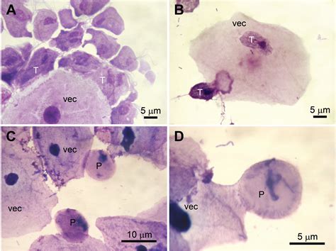 Pdf Infectivity Of Trichomonas Vaginalis Pseudocysts Inoculated Intra