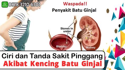 Maybe you would like to learn more about one of these? Ciri dan Tanda Sakit Pinggang Akibat Kencing Batu Ginjal ...
